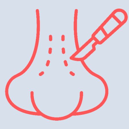 Rhinoplasty Rhinoplasty