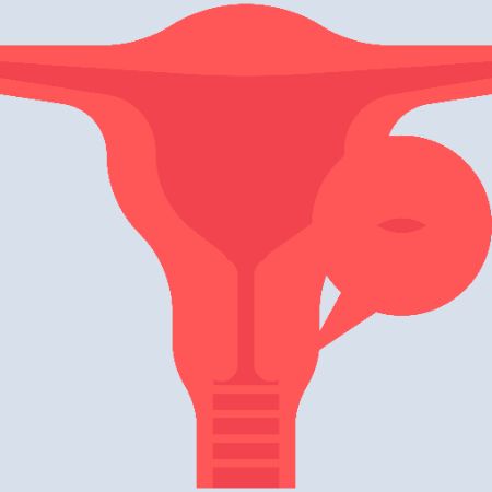 Cervical Cancer Cervical Cancer