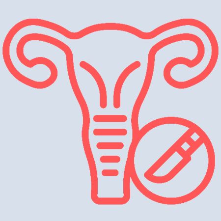 Hysterectomy